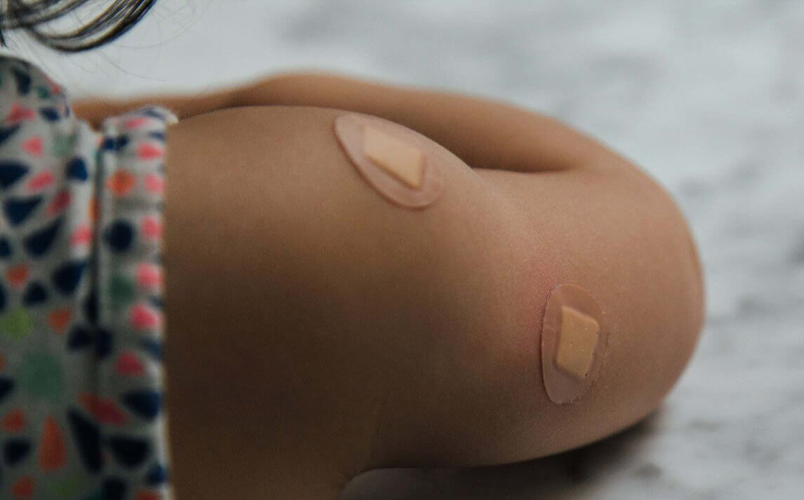 Picture of a person with plasters on arm